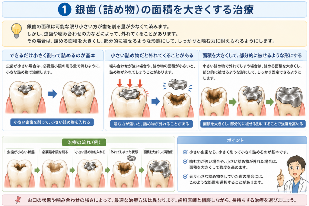 インレーの治し方のうちもう一回インレーで治すやり方を解説しています。