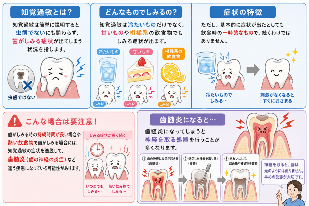 知覚過敏の付いてどのようなじゃ謡を指すのかを解説するイラストです。