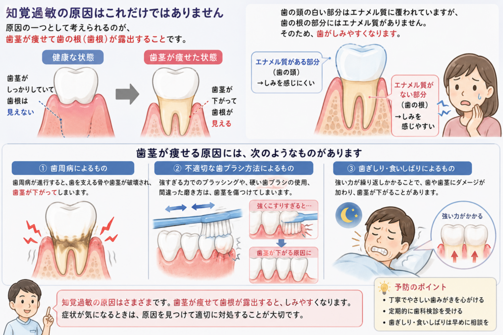 知覚過敏の原因について解説しているイラストです。