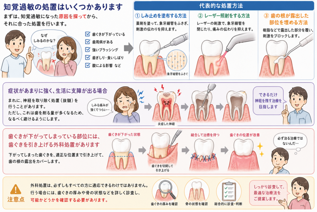 知覚過敏の処置法について解説しています