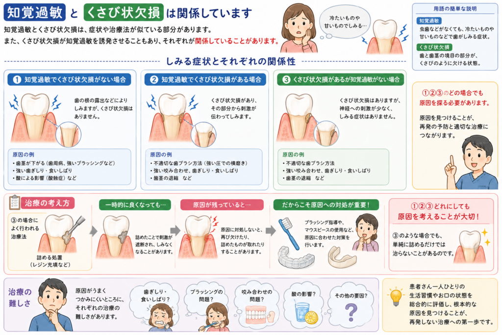 くさび状欠損と知覚過敏の密接な関係についてイラストで解説しています。