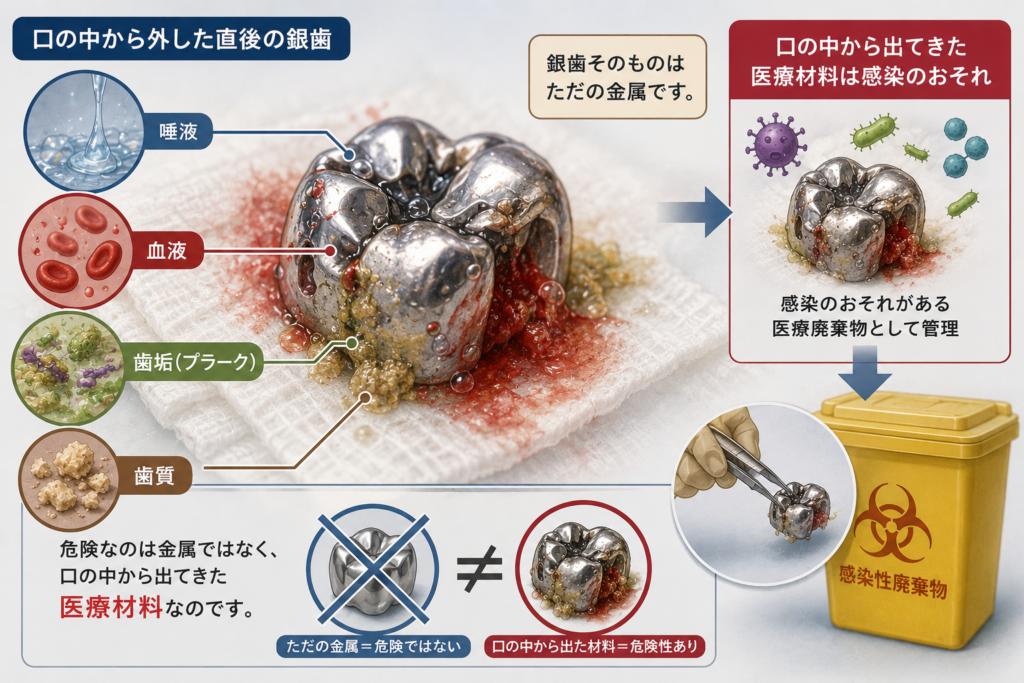 外した金歯や銀歯はただの金属ではなく、唾液、血液、プラーク、歯質が付いた汚染物質であるという解説図です。