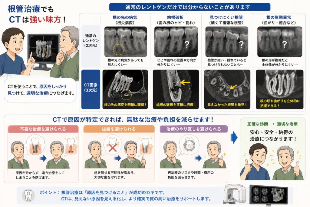 根幹治療においてもCTがどのように役に立つかを解説するイラストです。