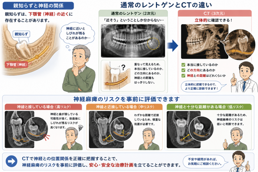 親知らず(智歯)の抜歯においてもCTが有効なことを示すイラストです。