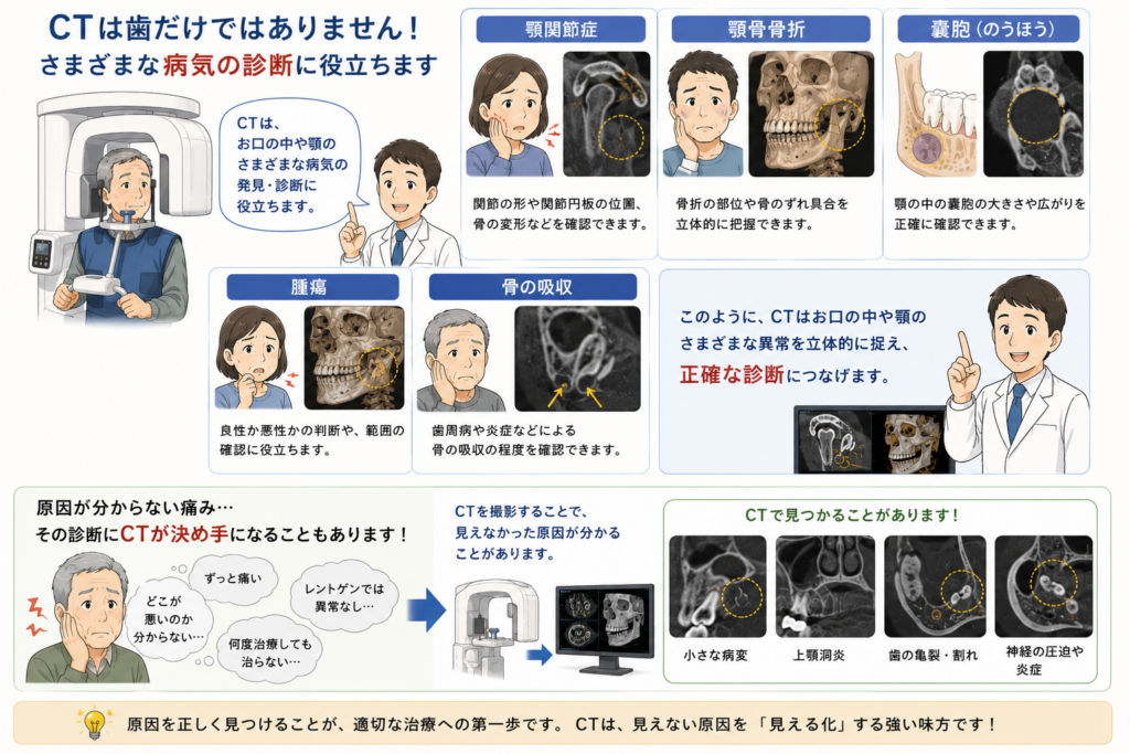 CTがインプラントや根幹治療、智歯の抜歯など以外にも役に立つことを解説するイラスト。腫瘍、骨折、嚢胞。