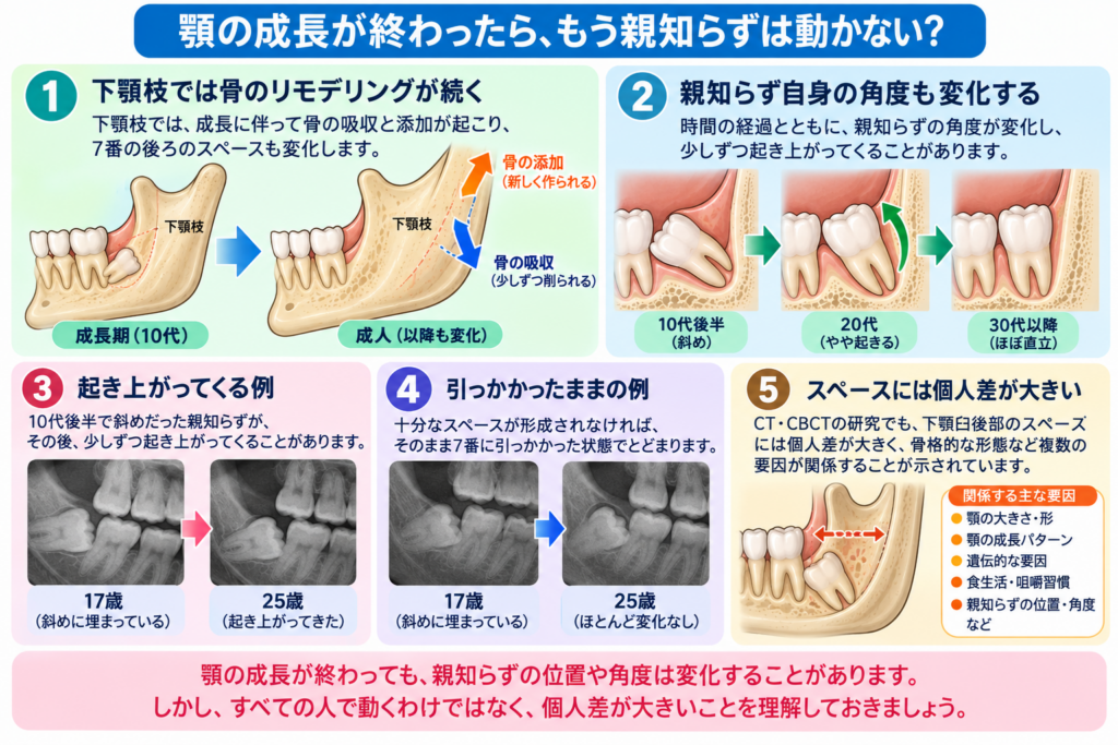 顎の成長が終わっても親知らずが起き上がってくることがあることの説明。
