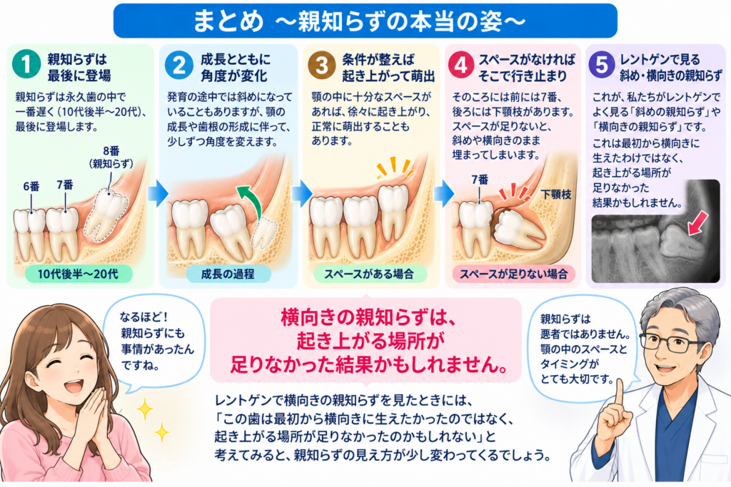 まとめとして、親知らずとあごの骨の関係を示す図