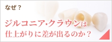 なぜ?ジルコニア・クラウンは仕上がりに差が出るのか?