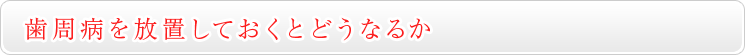 歯周病を放置しておくとどうなるか