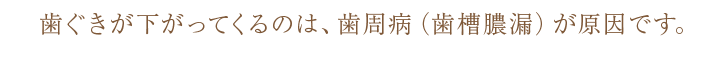 歯ぐきが下がってくるのは、歯周病（歯槽膿漏）が原因です。