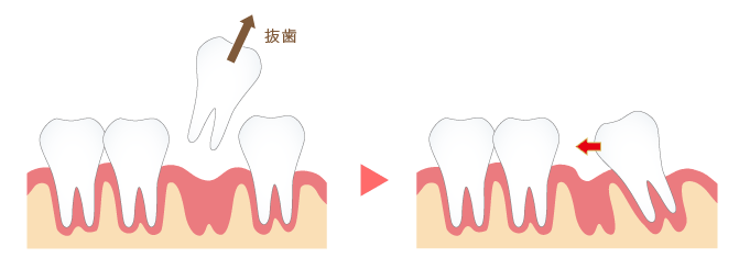 咬みあわせがおかしい。気分が優れない