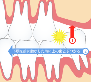 見た目が悪い